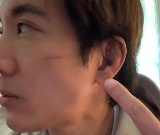  王力宏发视频透露伤情：明天拆线，下一站将取消威亚装置